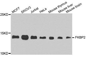 Western blot analysis of extract of various cells, using FKBP2 antibody. (FKBP2 抗体)