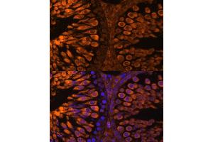 Immunofluorescence analysis of rat testis using LDHC Polyclonal Antibody (ABIN7268172) at dilution of 1:100 (40x lens). (Lactate Dehydrogenase C 抗体  (AA 150-250))