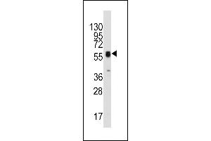 Western blot analysis of anti-ECGF1(Center) Pab (ABIN391460 and ABIN2841435) in HepG2 cell line lysates (35 μg/lane). (Thymidine Phosphorylase 抗体  (AA 318-345))