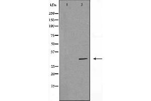 Western blot analysis of Hela whole cell lysates, using PHB Antibody. (Prohibitin 抗体  (Internal Region))
