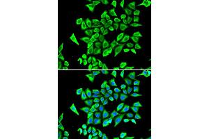 Immunofluorescence analysis of A549 cell using LCN2 antibody. (Lipocalin 2 抗体)