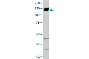 Western Blotting (WB) image for anti-Topoisomerase I Binding, arginine/serine-Rich, E3 Ubiquitin Protein Ligase (TOPORS) (AA 98-205) antibody (ABIN564418)
