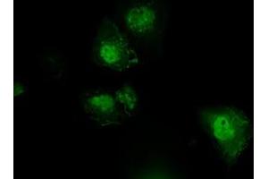 Anti-PLEK mouse monoclonal antibody (ABIN2453486) immunofluorescent staining of COS7 cells transiently transfected by pCMV6-ENTRY PLEK (RC203780). (Pleckstrin 抗体)