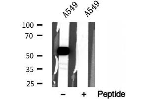 Western Blotting (WB) image for anti-Solute Carrier Family 30 (Zinc Transporter), Member 7 (SLC30A7) (N-Term) antibody (ABIN6266145)