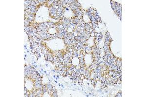 Immunohistochemistry (IHC) image for anti-Acetyl-CoA Acetyltransferase 2 (ACAT2) (AA 1-97) antibody (ABIN6136417)
