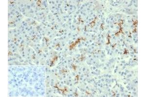 Formalin-fixed, paraffin-embedded human pancreas stained with CFTR Recombinant Mouse Monoclonal Antibody (rCFTR/6476). (CFTR 抗体  (AA 258-385))