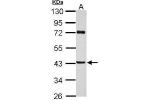 WB Image Sample (30 ug of whole cell lysate) A: JC 10% SDS PAGE antibody diluted at 1:1000 (SERPINB2 抗体  (Center))