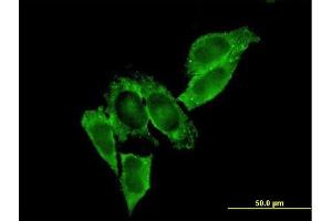 Immunofluorescence (IF) image for anti-Matrix Metallopeptidase 9 (Gelatinase B, 92kDa Gelatinase, 92kDa Type IV Collagenase) (MMP9) (AA 1-707) antibody (ABIN517965)