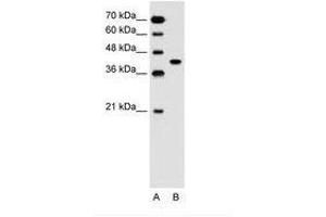 Image no. 1 for anti-Solute Carrier Family 35, Member B1 (SLC35B1) (AA 288-337) antibody (ABIN205013) (SLC35B1 抗体  (AA 288-337))