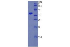 SDS-PAGE (SDS) image for Sulfotransferase Family, Cytosolic, 1A, Phenol-Preferring, Member 1 (SULT1A1) protein (ABIN3011143)