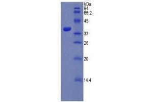 SDS-PAGE analysis of Rat PST Protein. (SULT1A1 蛋白)