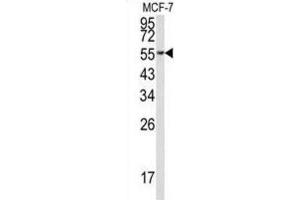 Western Blotting (WB) image for anti-Eukaryotic Translation Elongation Factor 1 alpha 1 (EEF1A1) antibody (ABIN3002705) (eEF1A1 抗体)