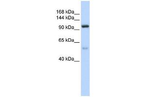 NOL6 antibody used at 1 ug/ml to detect target protein. (Nucleolar Protein 6 抗体)