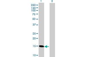 Western Blot analysis of RCAN1 expression in transfected 293T cell line by RCAN1 MaxPab polyclonal antibody. (RCAN1 抗体  (AA 1-117))