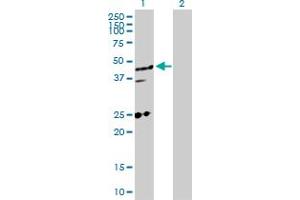 Western Blot analysis of MED27 expression in transfected 293T cell line by MED27 MaxPab polyclonal antibody. (MED27 抗体  (AA 1-311))