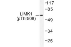 Image no. 1 for anti-LIM Domain Kinase 1 (LIMK1) (pThr508) antibody (ABIN318062) (LIM Domain Kinase 1 抗体  (pThr508))