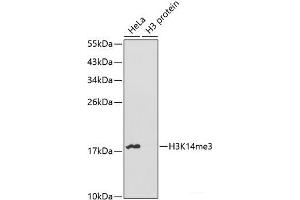 Western blot analysis of extracts of various cell lines using TriMethyl-Histone H3-K14 Polyclonal Antibody. (Histone 3 抗体  (3meLys14))