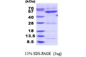 SDS-PAGE (SDS) image for Glucosidase, Beta, Acid 3 (Cytosolic) (GBA3) (AA 1-469) protein (His tag) (ABIN5853925)