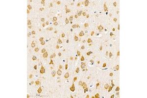 Immunohistochemistry of paraffin embedded mouse brain using Neurokinin-A (ABIN7075824) at dilution of 1:1100 (400x lens) (NKA 抗体)