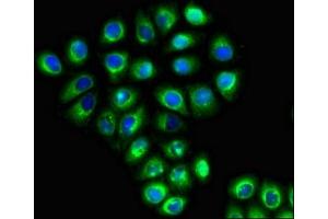 Immunofluorescent analysis of A549 cells using ABIN7169952 at dilution of 1:100 and Alexa Fluor 488-congugated AffiniPure Goat Anti-Rabbit IgG(H+L) (SLC6A13 抗体  (AA 1-40))