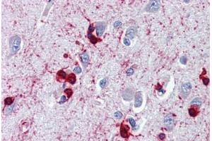Brain, cortex, Human: Formalin-Fixed, Paraffin-Embedded (FFPE) (CRYAB 抗体)