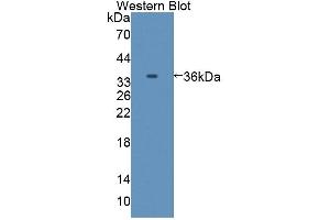Detection of Recombinant C8a, Mouse using Polyclonal Antibody to Complement Component 8a (C8a) (C8A 抗体  (AA 21-300))