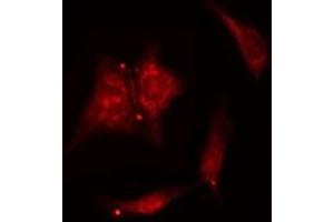 Immunofluorescence (fixed cells) (IF/ICC) image for anti-Prostaglandin E Synthase 3 (Cytosolic) (PTGES3) (C-Term) antibody (ABIN6264507)
