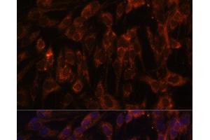 Immunofluorescence analysis of C6 cells using TLR3 Polyclonal Antibody at dilution of 1:100. (TLR3 抗体)