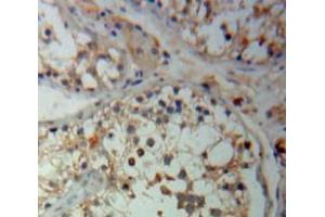 Used in DAB staining on fromalin fixed paraffin-embedded Testis tissue (Hexokinase 2 抗体  (AA 469-669))