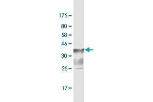 Western Blot detection against Immunogen (37. (SLC44A2 抗体  (AA 123-230))