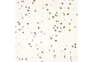 Immunohistochemistry (IHC) image for anti-N-Acetyltransferase 10 (GCN5-Related) (NAT10) antibody (ABIN7268774)