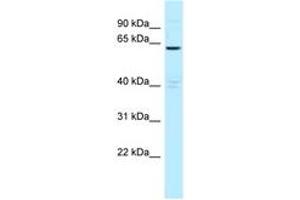 Image no. 1 for anti-Myotubularin Related Protein 6 (MTMR6) (AA 531-580) antibody (ABIN6747841) (MTMR6 抗体  (AA 531-580))