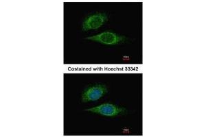 ICC/IF Image Immunofluorescence analysis of methanol-fixed HeLa, using ESE1, antibody at 1:500 dilution. (ELF3 抗体  (C-Term))