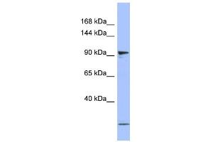 WB Suggested Anti-PSMD1 Antibody Titration: 0. (PSMD1 抗体  (N-Term))