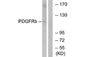 Western Blotting (WB) image for anti-Platelet Derived Growth Factor Receptor beta (PDGFRB) (AA 718-767) antibody (ABIN2889053) (PDGFRB 抗体  (AA 718-767))