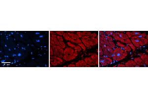 Rabbit Anti-TRIM39 Antibody    Formalin Fixed Paraffin Embedded Tissue: Human Adult heart  Observed Staining: Cytoplasmic Primary Antibody Concentration: 1:600 Secondary Antibody: Donkey anti-Rabbit-Cy2/3 Secondary Antibody Concentration: 1:200 Magnification: 20X Exposure Time: 0. (TRIM39 抗体  (Middle Region))