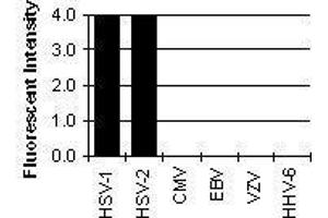 Cross Reactivity Results determined by IFA (HSV gB 抗体)