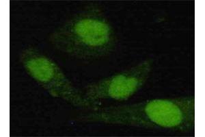 Immunofluorescence staining of HeLa cells using JARID1C monoclonal antibody  at 1:200 dilution. (KDM5C 抗体  (C-Term))