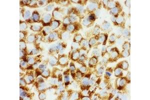 ICC testing of COL1A1 antibody and NIH3T3 cells