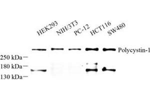 Western blot analysis of Polycystin-1 (ABIN7075124) at dilution of 1: 500 (PKD1 抗体)