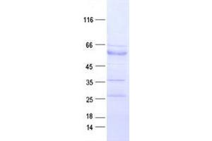 Validation with Western Blot (EPH Receptor B3 Protein (EPHB3) (DYKDDDDK Tag))