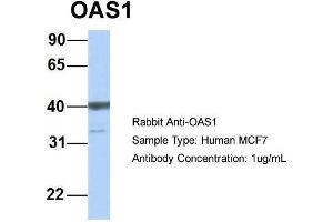 Host: Rabbit  Target Name: OAS1  Sample Tissue: Human MCF7  Antibody Dilution: 1. (OAS1 抗体  (C-Term))