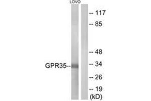 Western blot analysis of extracts from LOVO cells, using GPR35 Antibody. (GPR35 抗体  (AA 51-100))