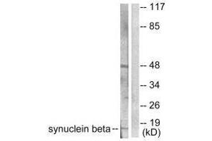 Western blot analysis of extracts from HeLa cells, using Synuclein β antibody.