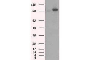 Image no. 2 for anti-Hexokinase 2 (HK2) antibody (ABIN1498647) (Hexokinase 2 抗体)