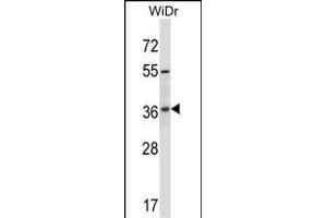 RIBC2 Antibody (N-term) (ABIN657503 and ABIN2846528) western blot analysis in WiDr cell line lysates (35 μg/lane). (RIBC2 抗体  (N-Term))