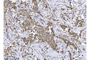 IHC analysis of SCA2/ATXN2 using anti-SCA2/ATXN2 antibody (ABIN7599900).