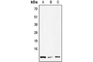 Western blot analysis of HMGN1 expression in Hela (A), NIH3T3 (B), H9C2 (C) whole cell lysates. (HMGN1 抗体  (Center))