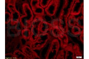 Formalin-fixed and paraffin embedded rat kidney labeled with Anti-Integrin Î±E2 Polyclonal Antibody, Unconjugated (ABIN678758) at 1:200 followed by conjugation to the secondary antibody Goat Anti-Rabbit IgG, PE conjugated used at 1:200 dilution for 40 minutes at 37 °C. (Integrin, alpha E2 (AA 1101-1179) 抗体)