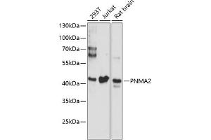 Western blot analysis of extracts of various cell lines, using PNM antibody (ABIN6128525, ABIN6145844, ABIN6145845 and ABIN6220635) at 1:3000 dilution. (PNMA2 抗体  (AA 1-140))